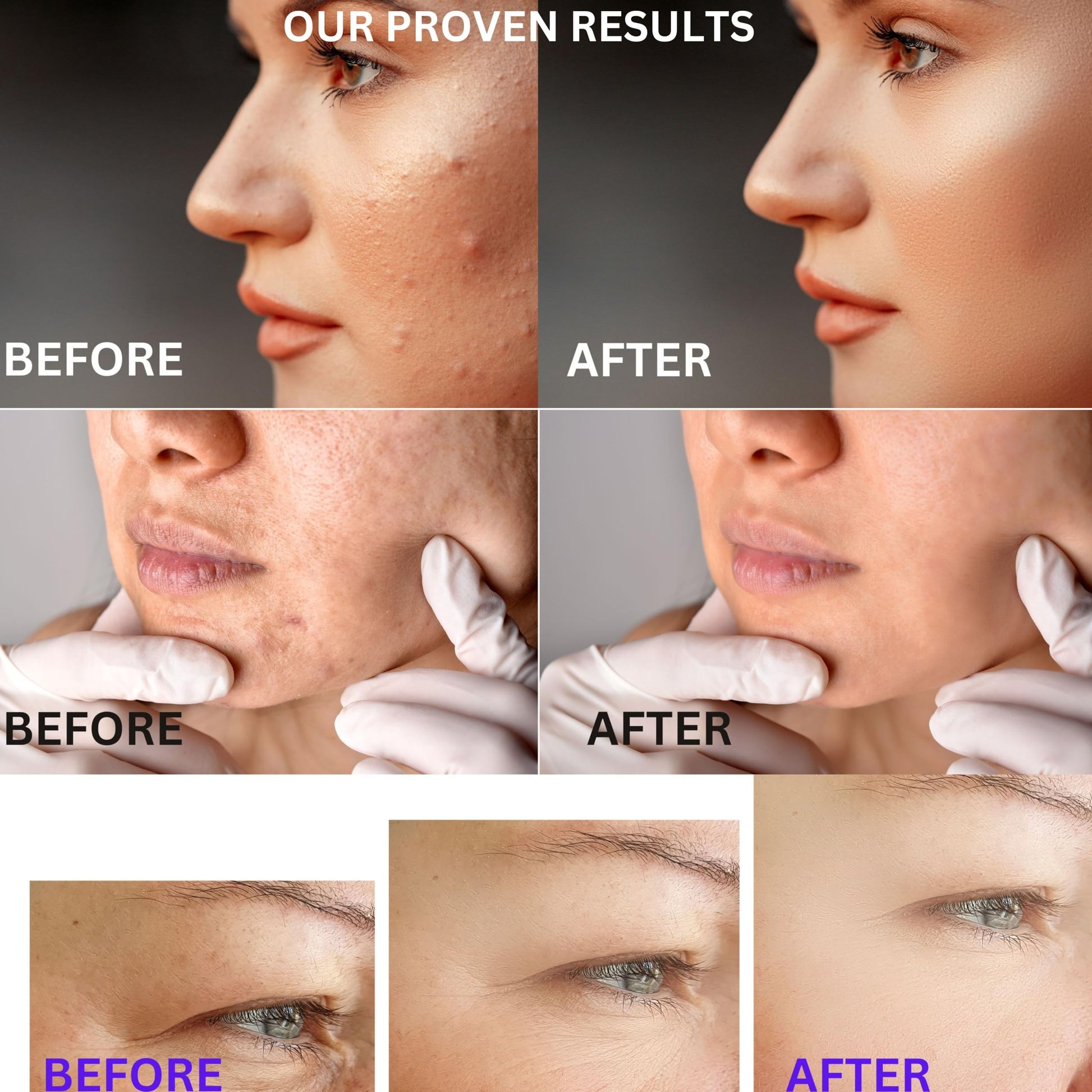 SkinVitalize C E ferulux Vitamin C Serum - 30ml: Advanced Formula for Fighting with Wrinkles Msupps.com uk supplements