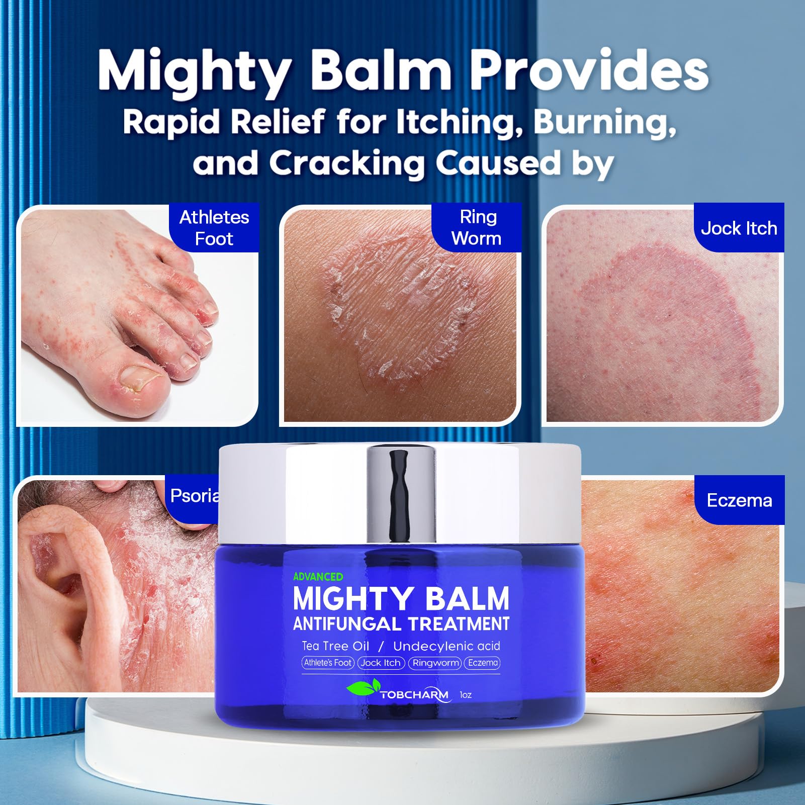 Tobcharm Antifungal Cream, Antifungal Cream for Skin, Ringworm Treatment for Humans Tobcharm uk supplements