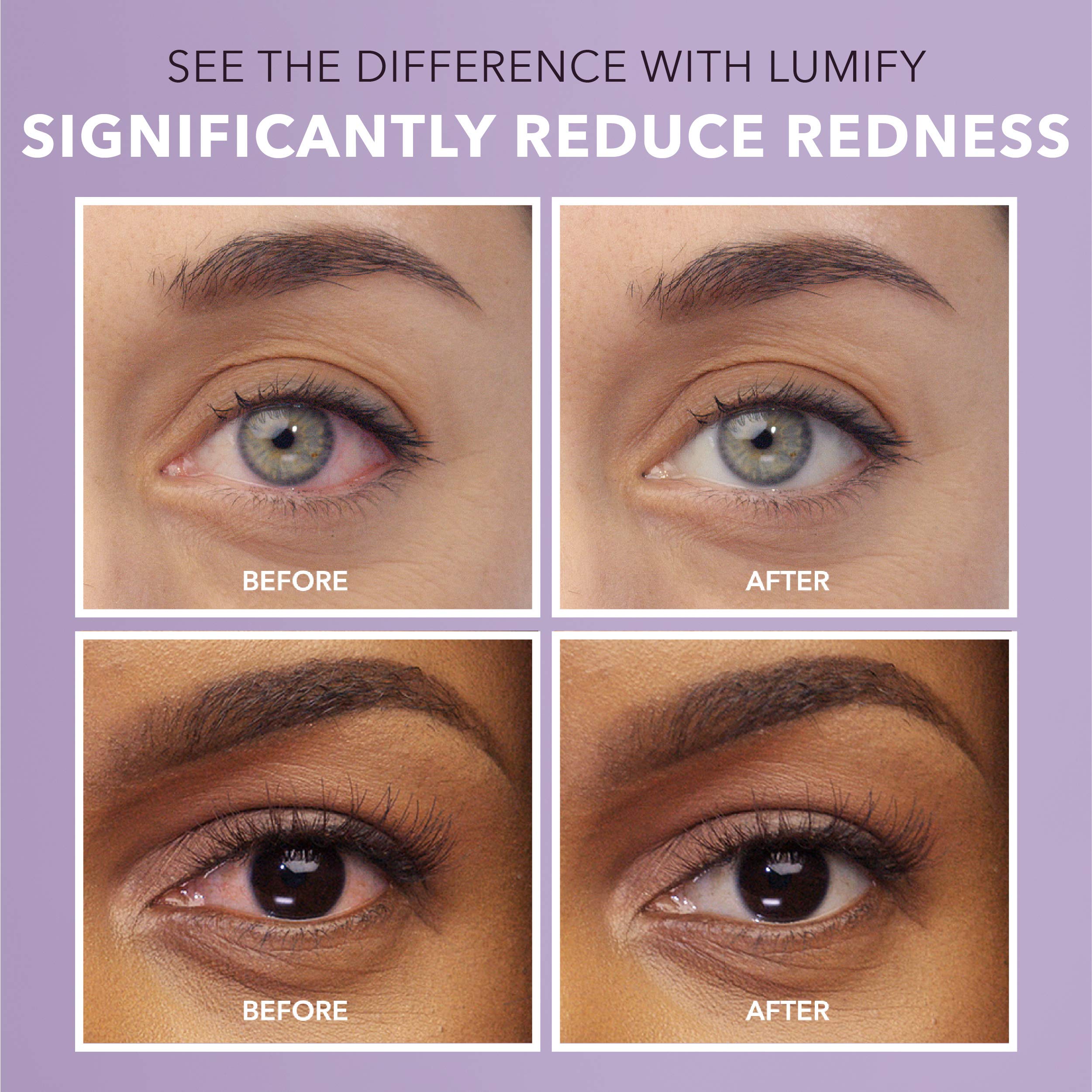 LUMIFY Eye Drops for Red Eyes, Redness Reliever for Brighter Looking Eyes, Works in 1 Minute & Lasts Up to 8 Hours, Eye Drops, 0.25 Fl Oz (7.5mL) LUMIFY uk supplements