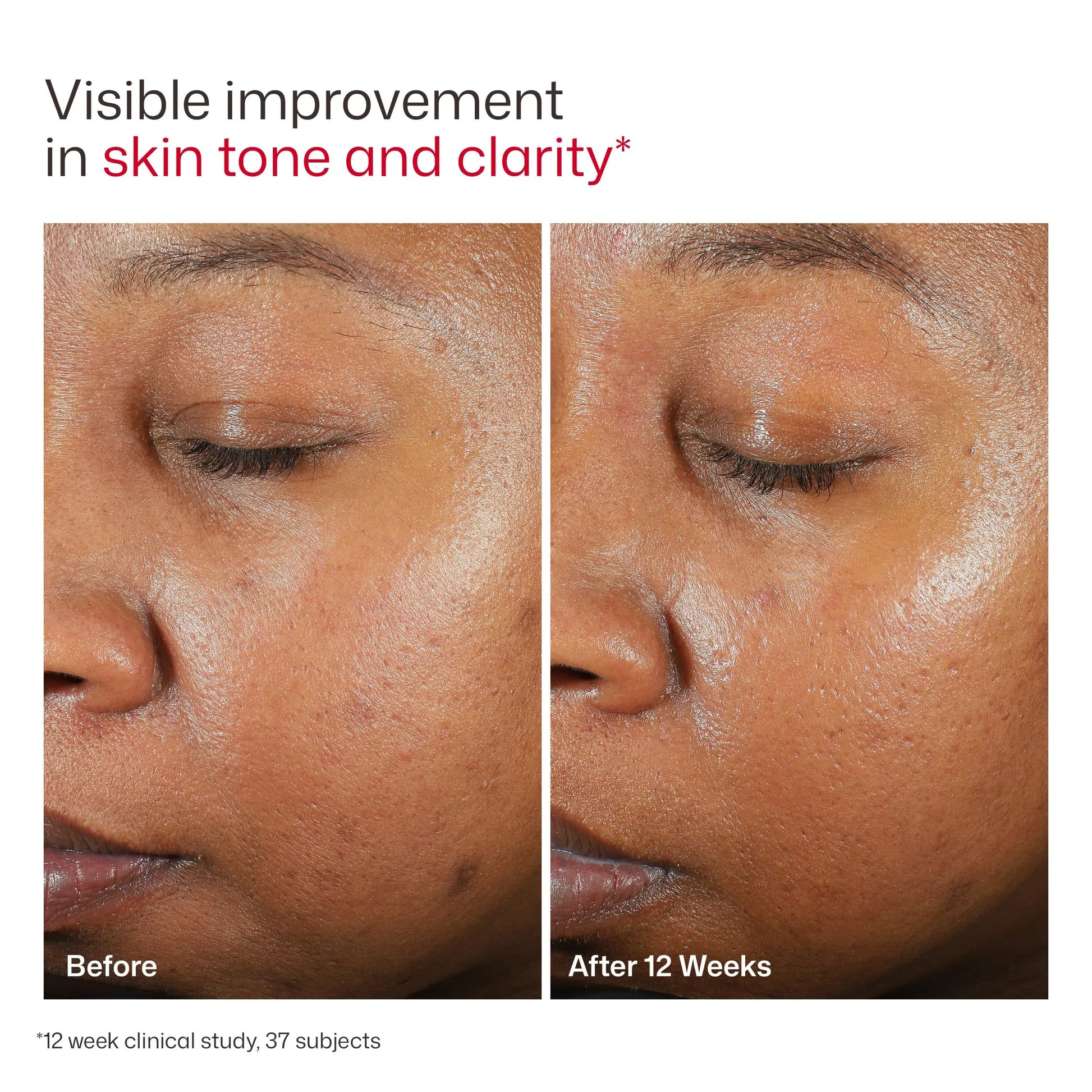 EltaMD UV Clear Tinted Sunscreen for Face, SPF 46 with Zinc Oxide, Oil-Free, Dermatologist Recommended, For Acne-Prone Sensitive Skin, 1.7 oz EltaMD uk supplements